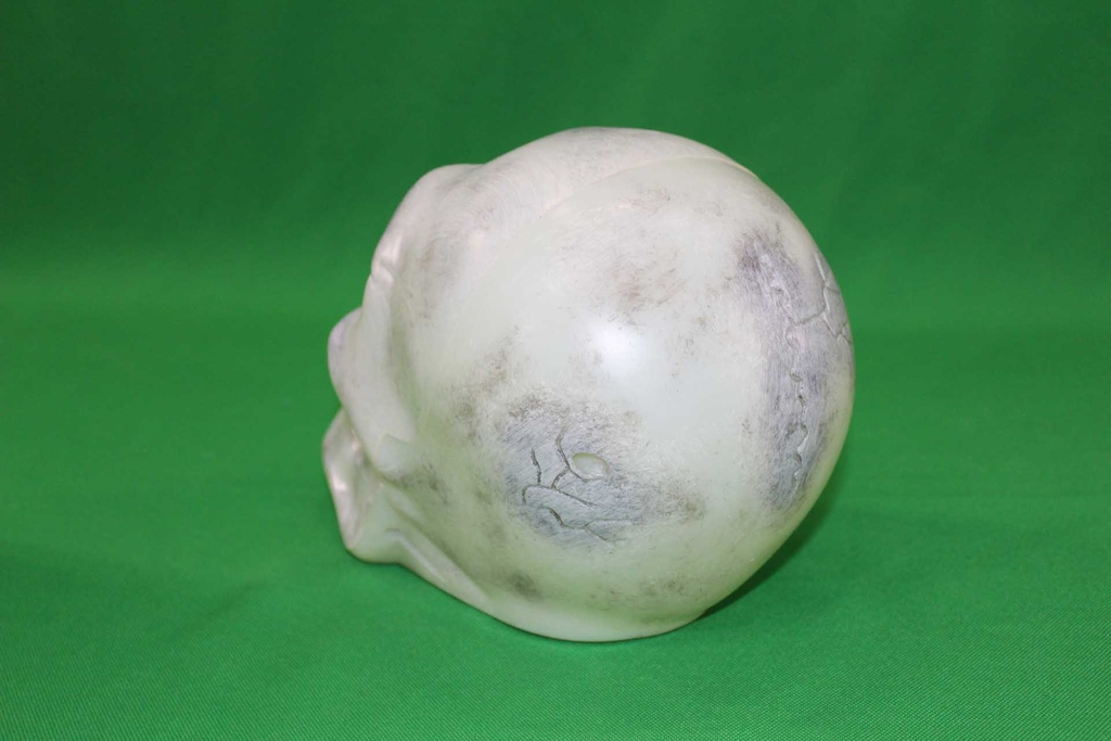 Human Skull