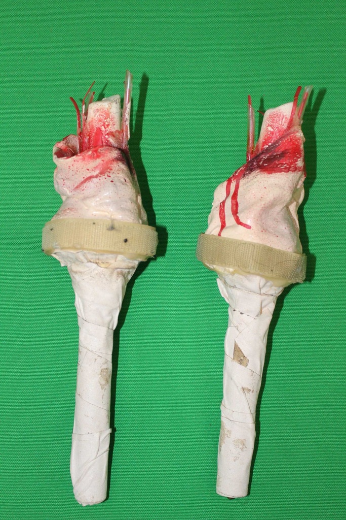 Bloody Hand Stumps