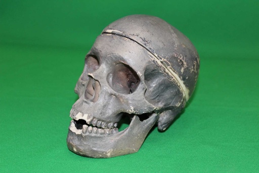 [PMB-020] Human Skull